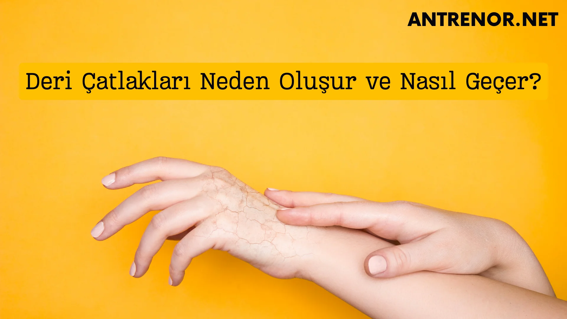 Deri Çatlakları Neden Oluşur ve Nasıl Geçer?